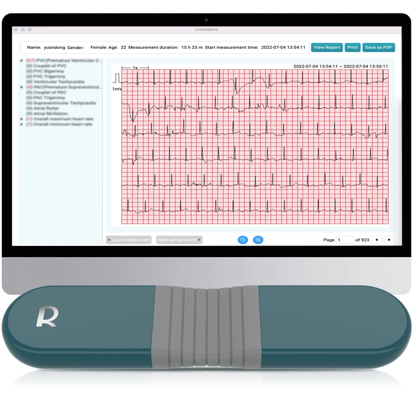 Livenpace AI HR Monitor 24 Hours Chest Lead Device with Free AI Analysis & PC Report Chargeable Recorder HHM1